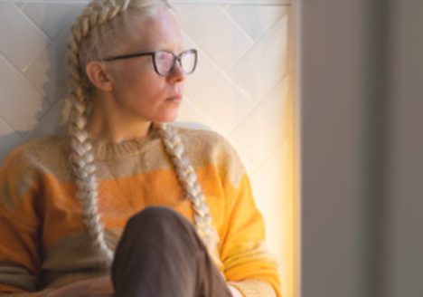 types of albinism