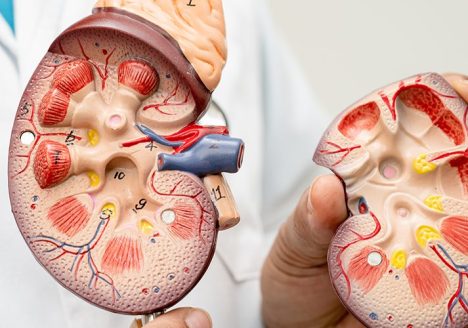 Chronic Kidney Disease